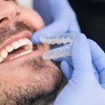 Invisalign Dentist