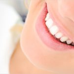 Teeth whitening